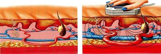 als uw benen gevoelloos worden